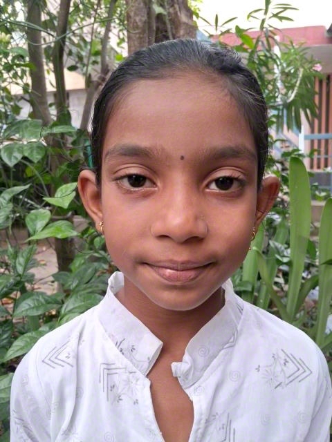 World Vision India